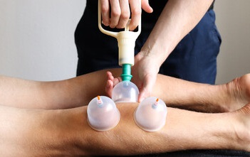 healthcare provider applying orthopedic cupping to a client's calf muscle.