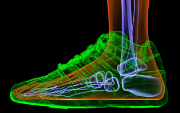 X-ray like image of an ankle, foot, and shoe