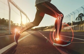 Athlete running on a track with xray image of the bones in the leg