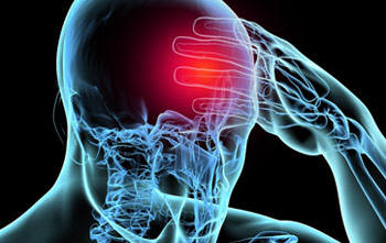 Image of a stroke