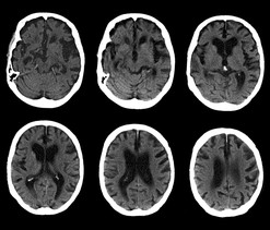 brain scan images