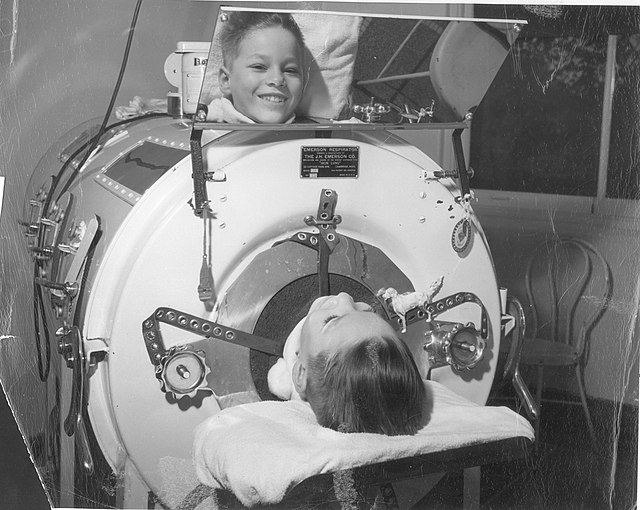 boy in an iron lung for polio.