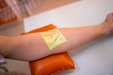 Vein finder on patient's arm