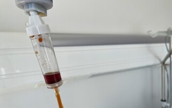 IV tubing drip chamber with dark iron infusion dripping.