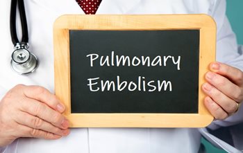 Pulmonary Embolism - Pedagogy Education